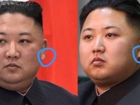 وضعیت سلامت رهبر کره شمالی