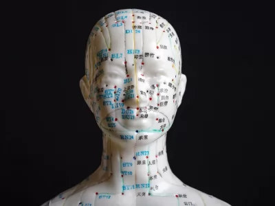 کاربرد هوش مصنوعی در طب سوزنی چیست؟